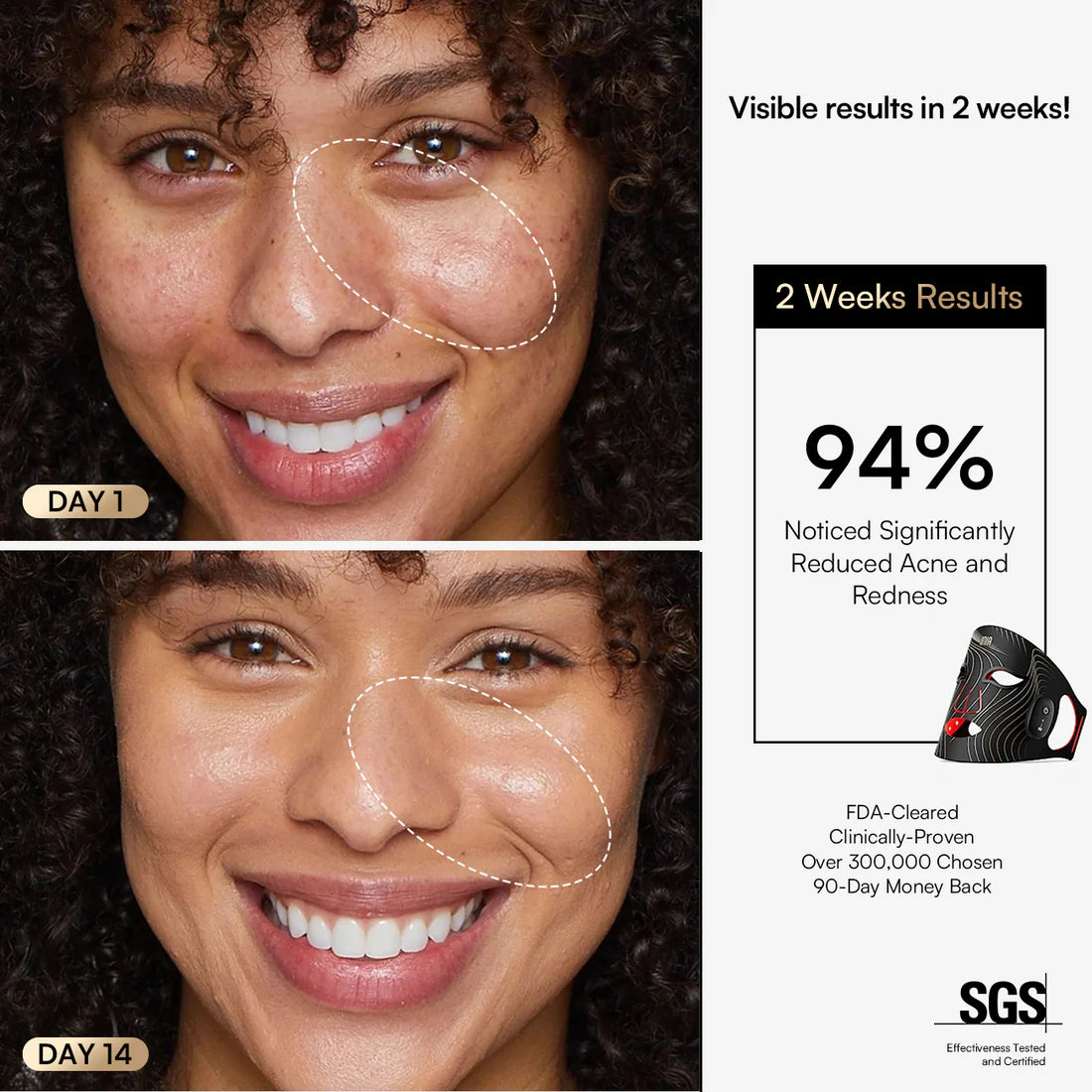 Radiance Rejuvenation LED Mask™