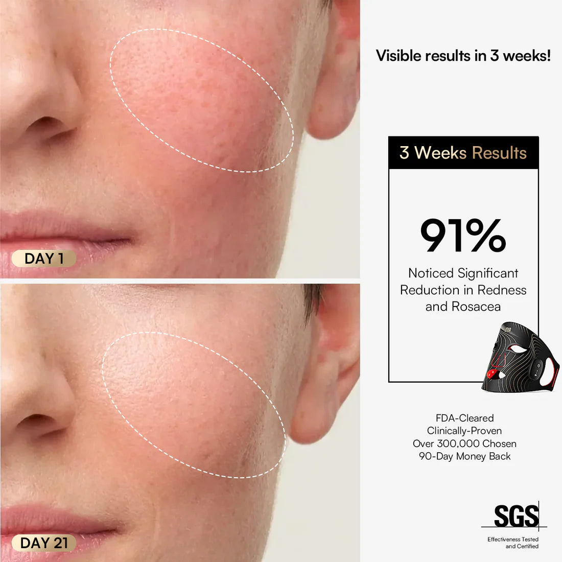 Radiance Rejuvenation LED Mask™