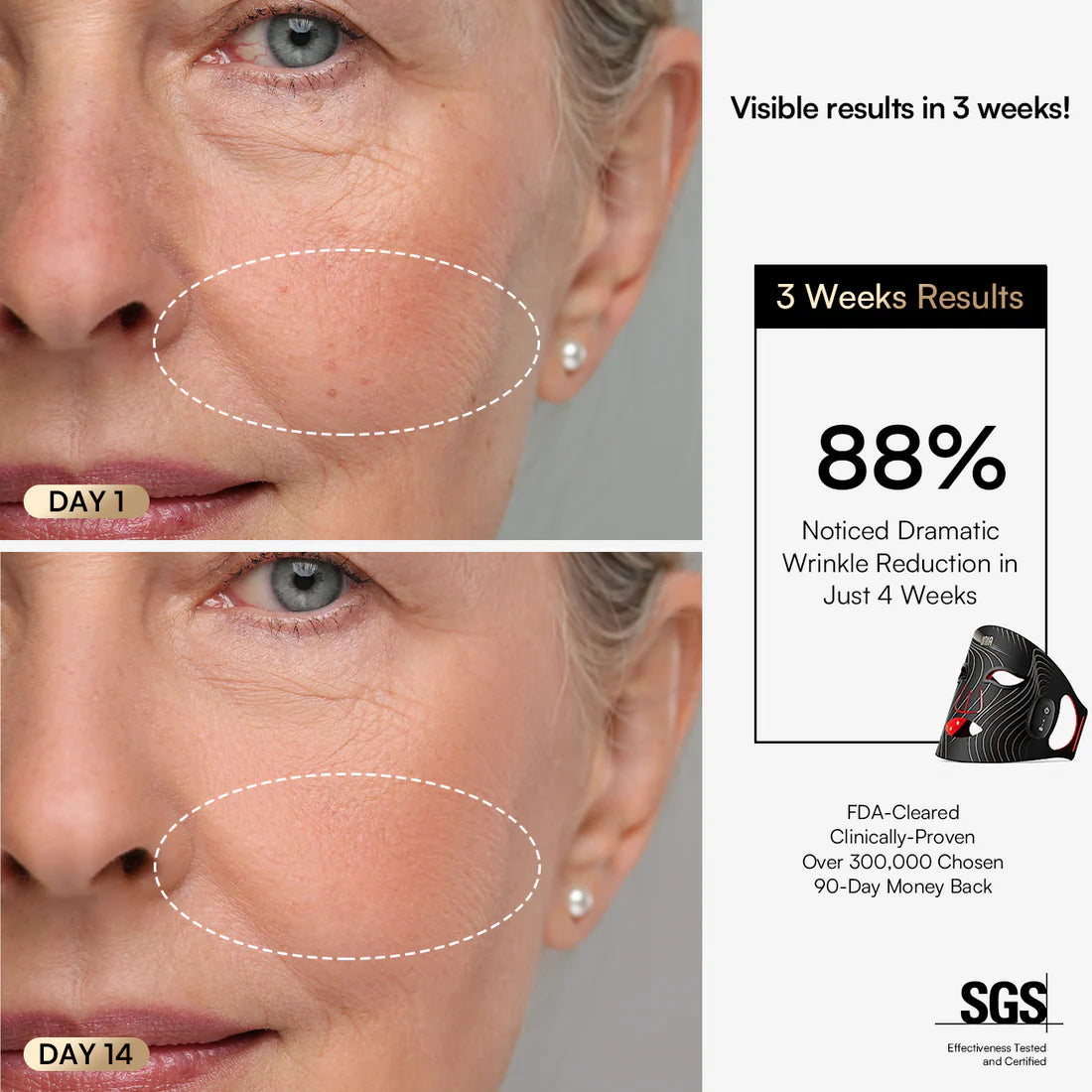 Radiance Rejuvenation LED Mask™